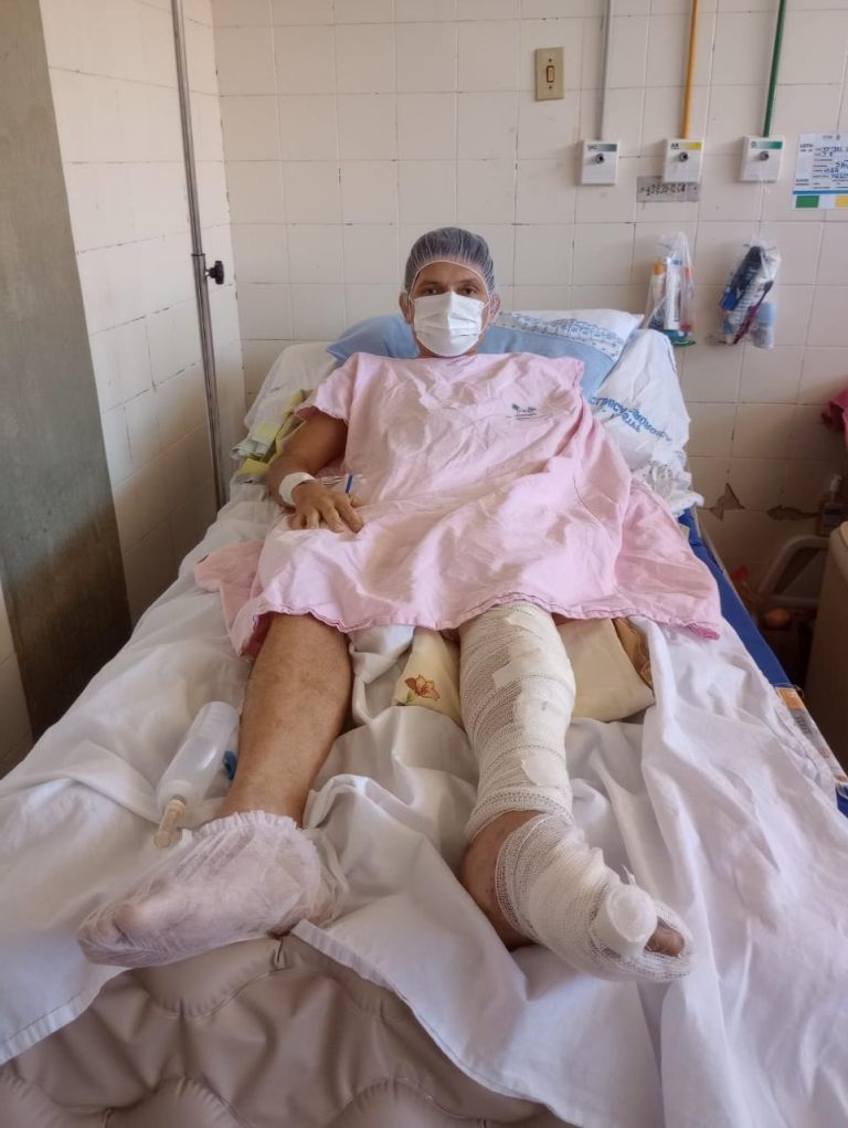 Cabeleireiro envolvido em grave acidente na RN-288 vai receber alta hospitalar; Amigo não teve a mesma sorte