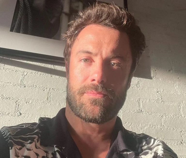Ator da globo é atropelado e está em estado grave