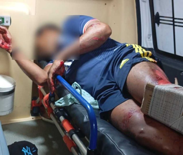 Acidente na RN-288 deixa homem lesionado com fratura exposta; Vítima é submetida à cirurgia no HRS