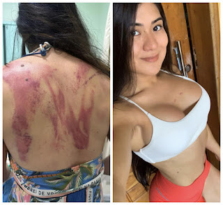 Pai tenta matar filha influenciadora de 32 anos a golpes de facão.