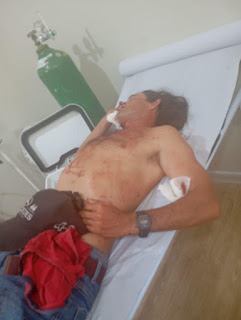 Homem é esfaqueado no Oeste do RN.