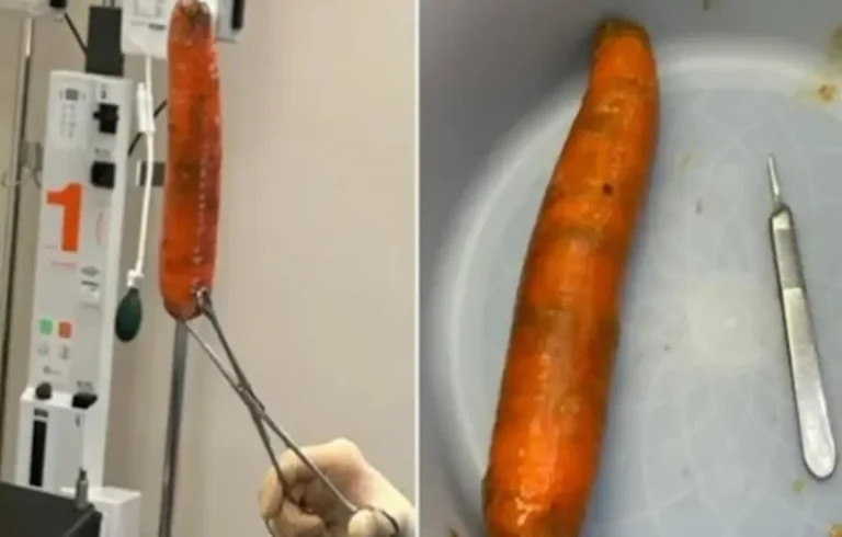 Homem da entrada no pronto-socorro uma cenoura de 20cm introduzida no reto