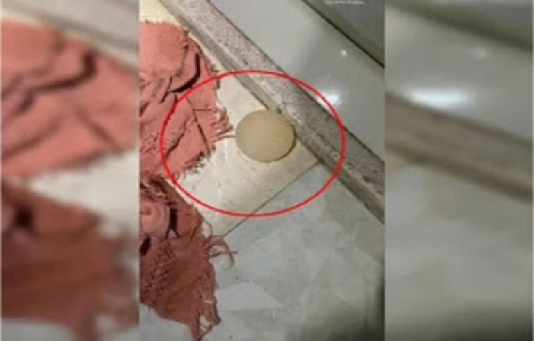 Bárbaro: Mulher tem prótese de silicone retirada com faca 🗡️ pelo marido.