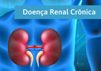 Assú: Serviços voltados a pessoas com doença renal crônica foram contratados por R$ 5,2 milhões